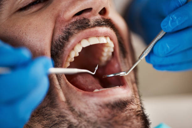 Best Emergency Dental Care for Broken or Chipped Teeth in Columbus Grove, OH